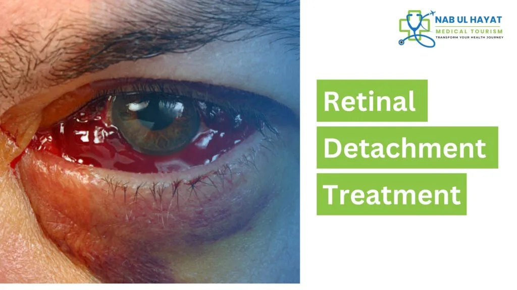 Retinal Detachment Surgery in India