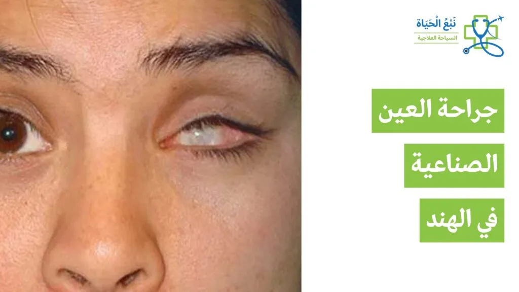 جراحة العيون الاصطناعية في الهند