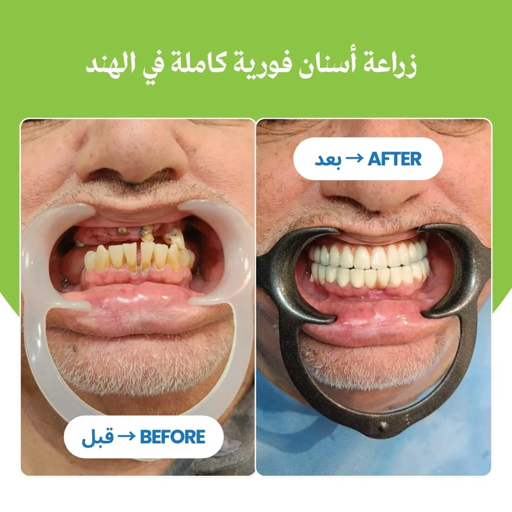 بدر عبد الرحمن