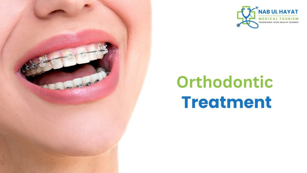 Orthodontic Implants in India