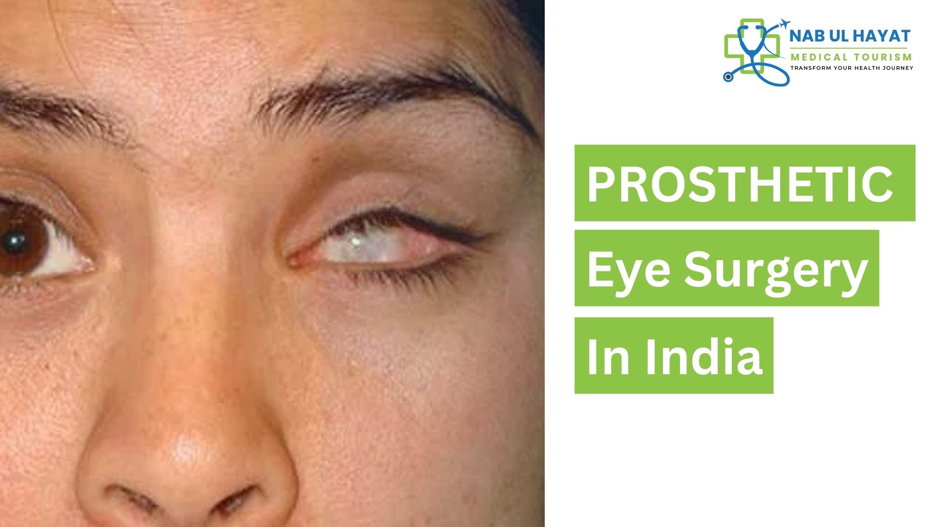 Prosthetic Eye Surgery