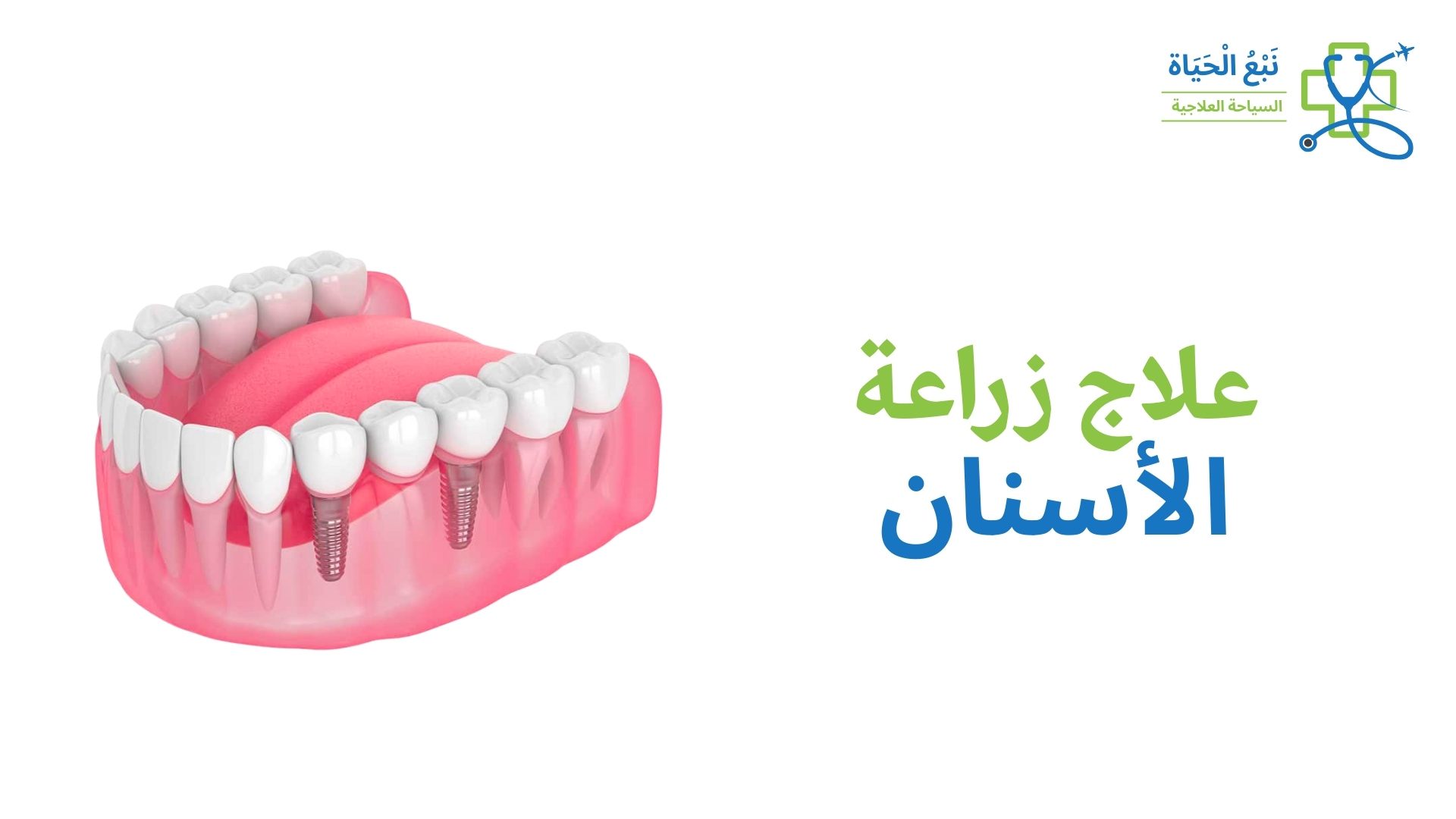 زراعة الأسنان في الهند