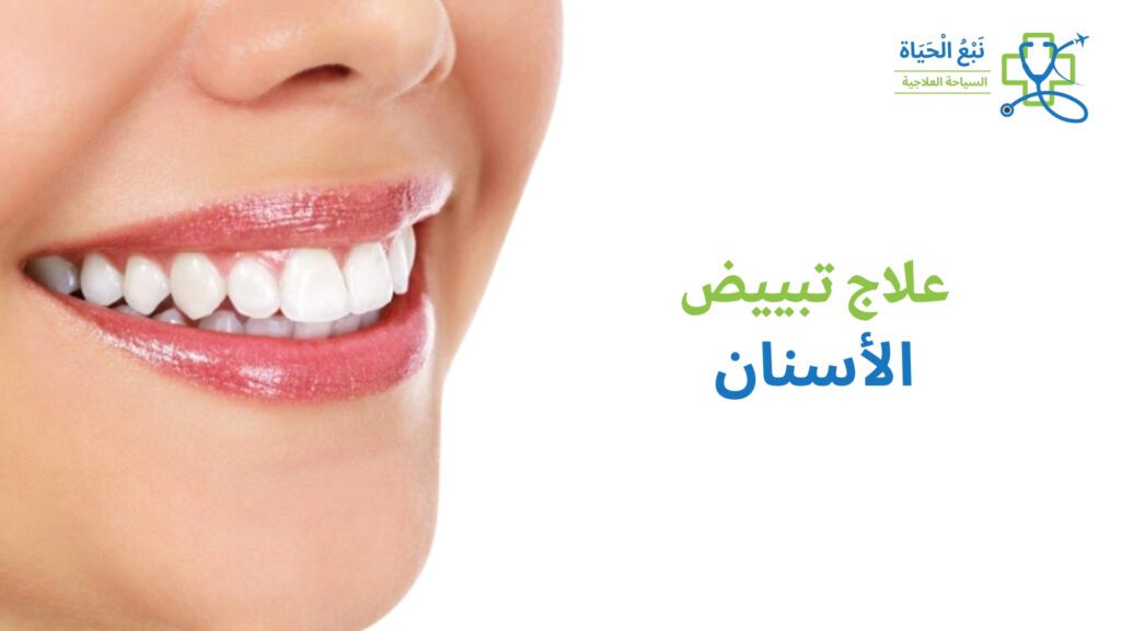 تبييض الأسنان
