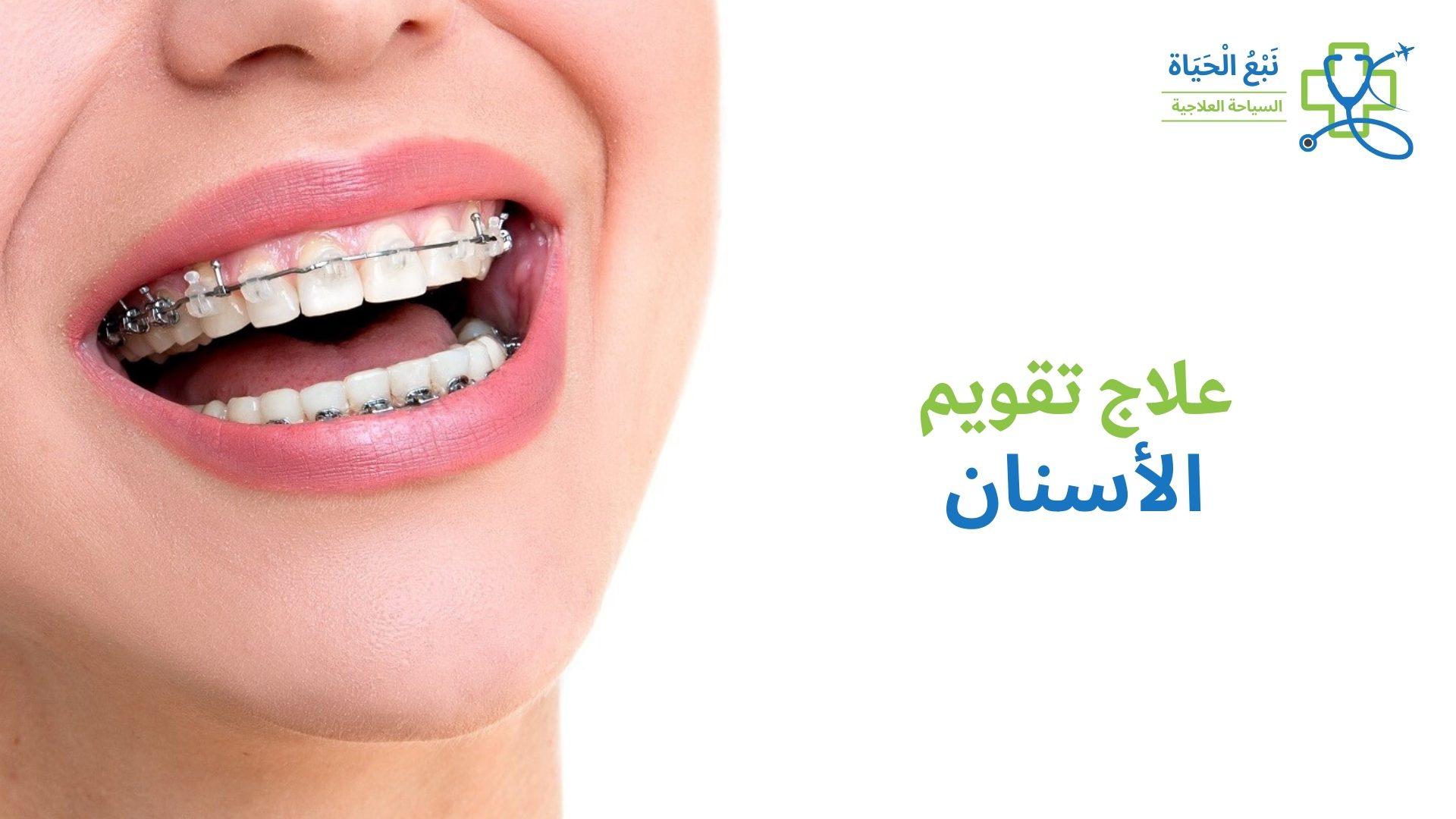 علاجات تقويم الأسنان