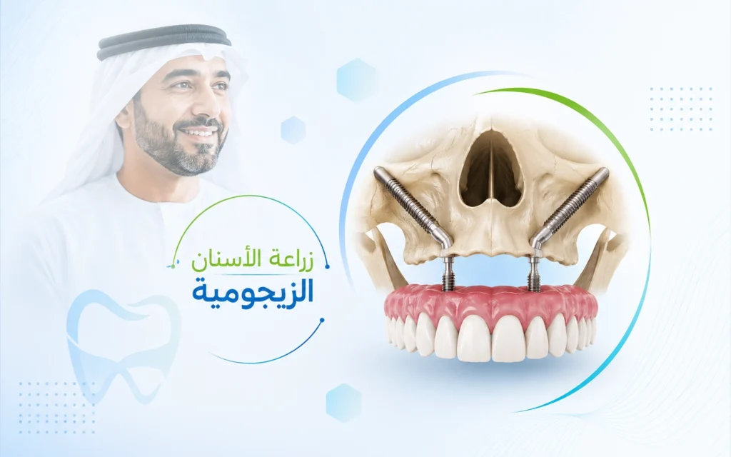 زراعة الأسنان الزيجومية في الهند