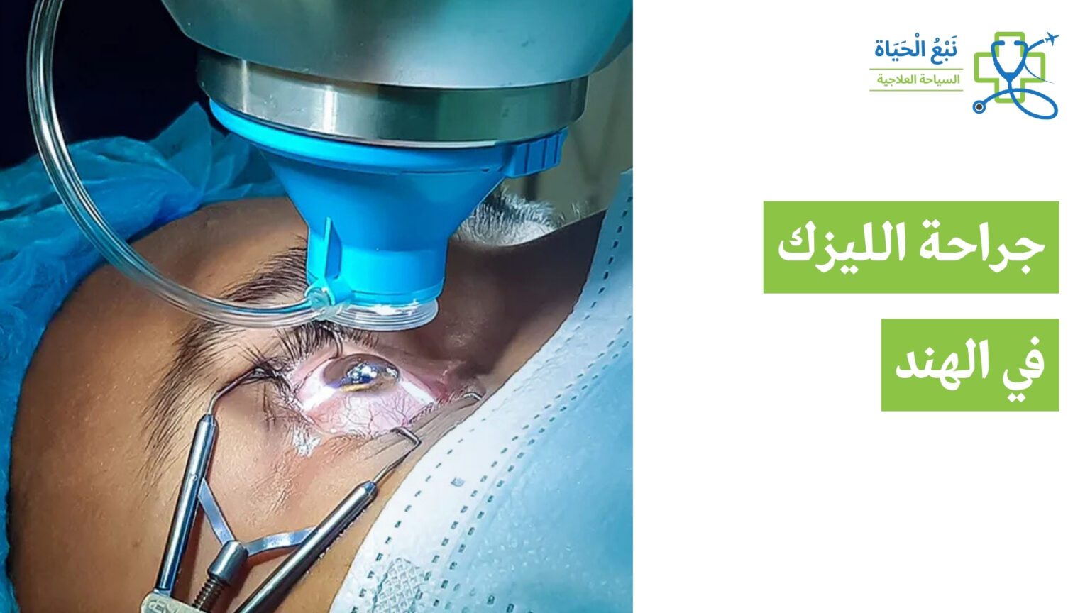 جراحة الليزك في الهند: تصحيح متقدم للرؤية بأسعار ميسورة