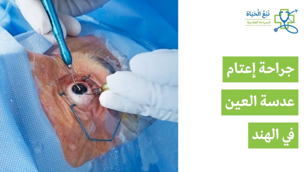 جراحة إعتام عدسة العين بأسعار معقولة في الهند