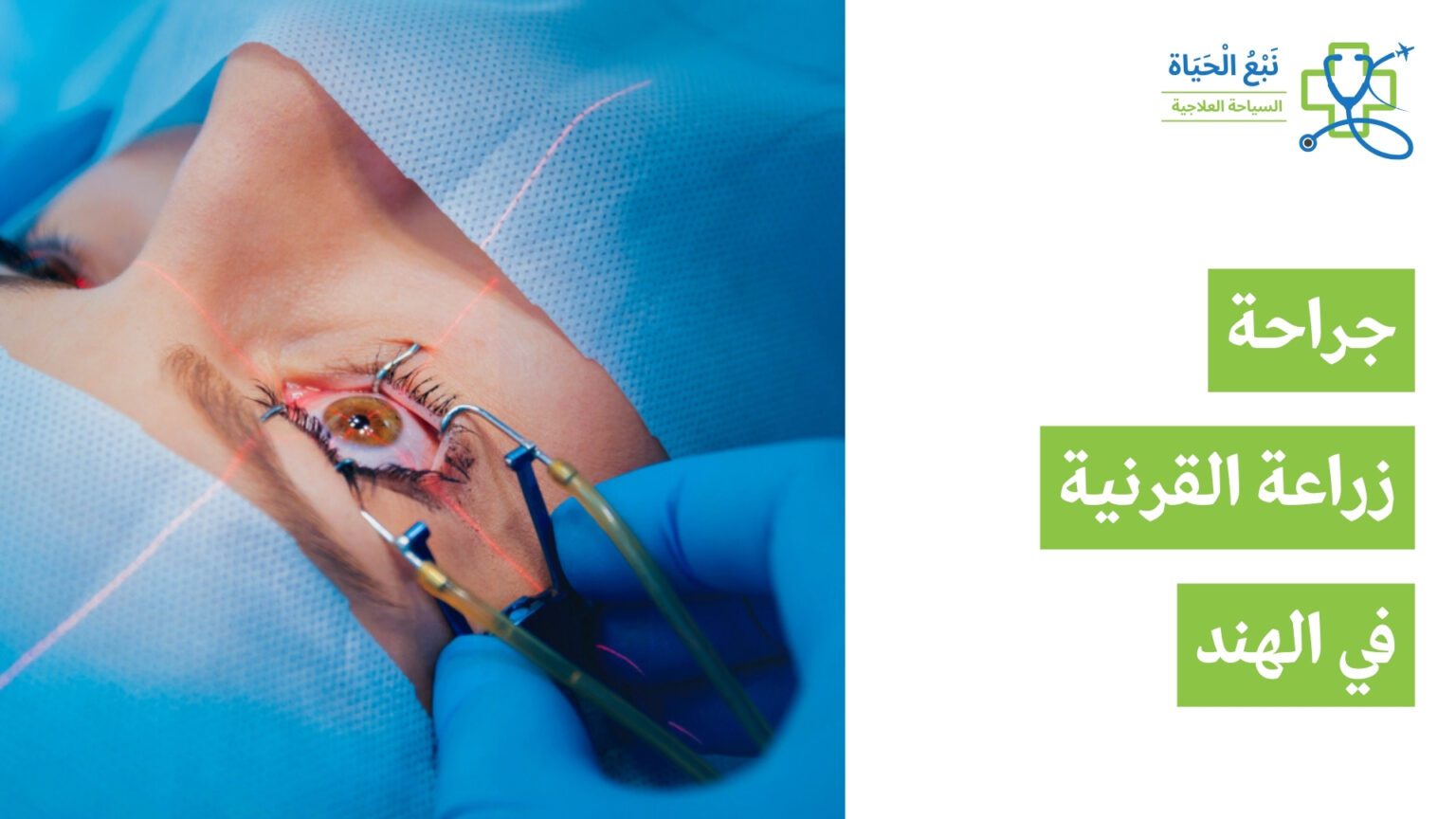 جراحة زرع القرنية في الهند: استعادة الرؤية المتقدمة بتكاليف معقولة