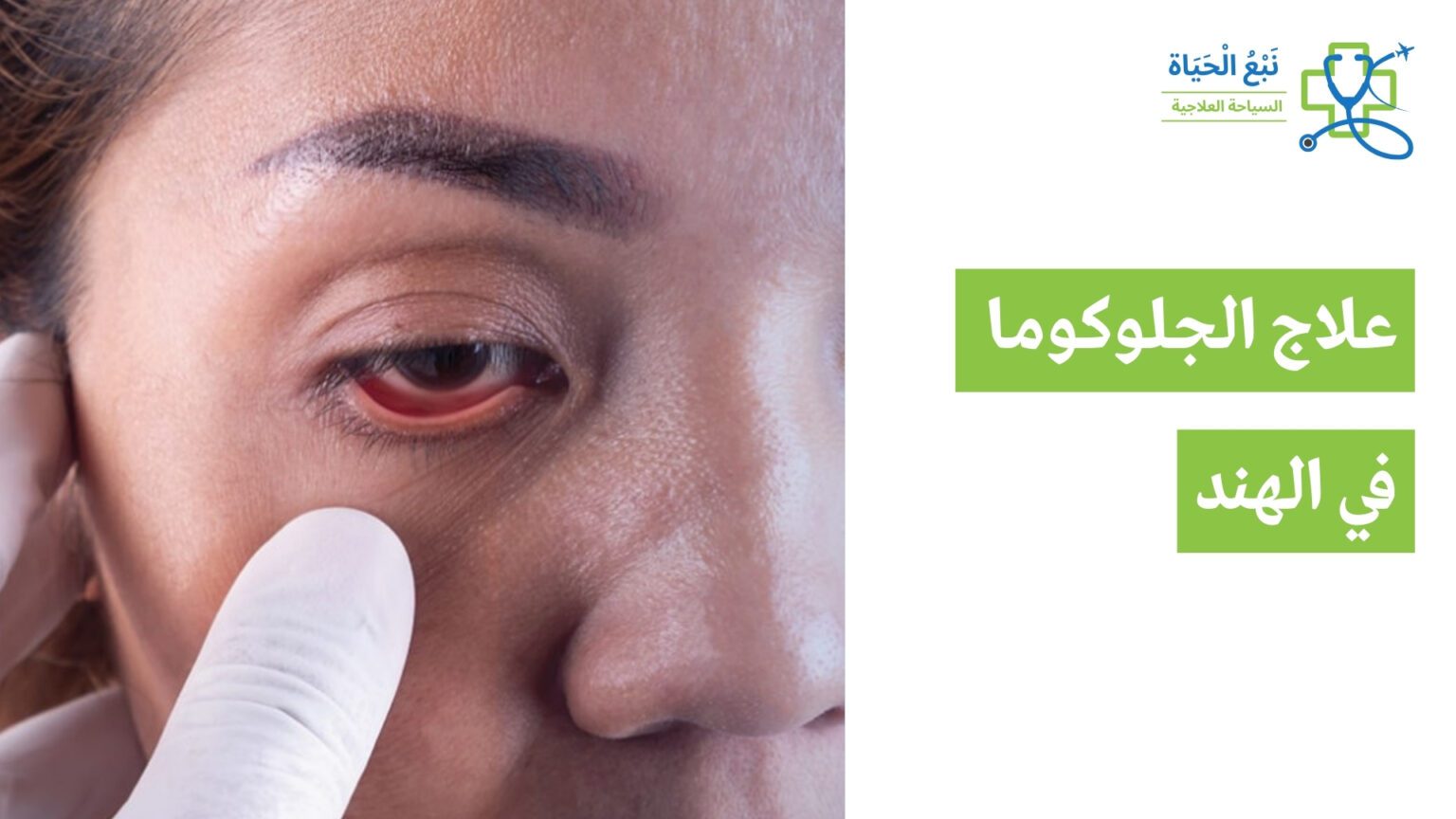 علاج الجلوكوما في الهند: رعاية عيون متقدمة وبأسعار معقولة