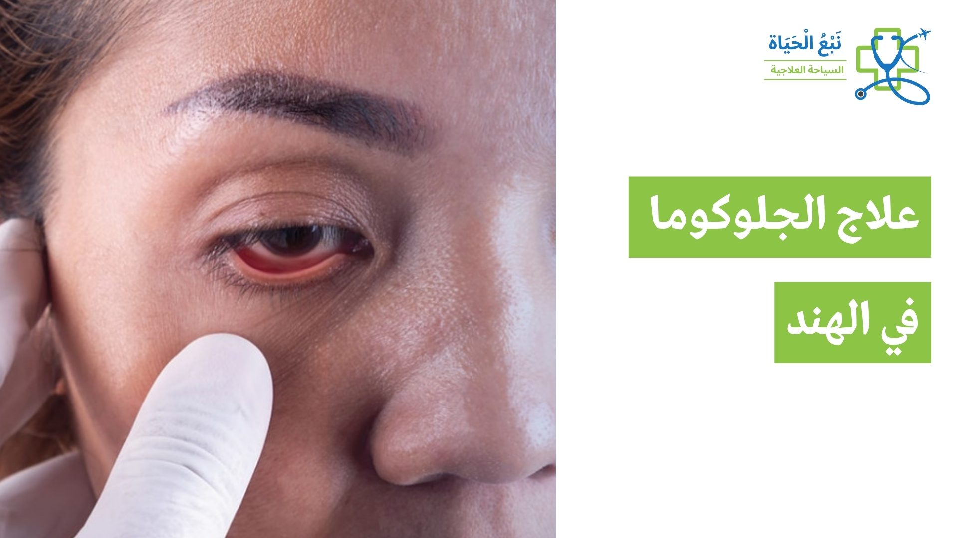 علاج الجلوكوما