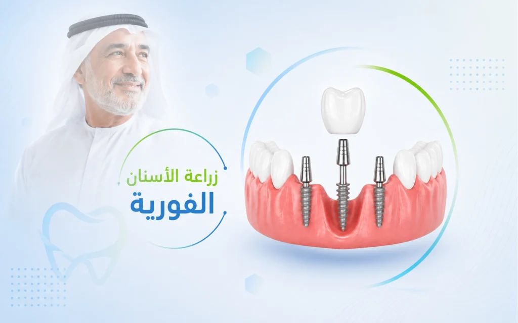 زراعة الأسنان الفورية في الهند