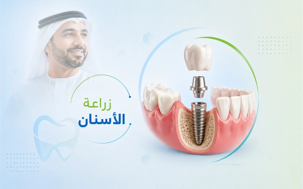 زراعة الأسنان في الهند