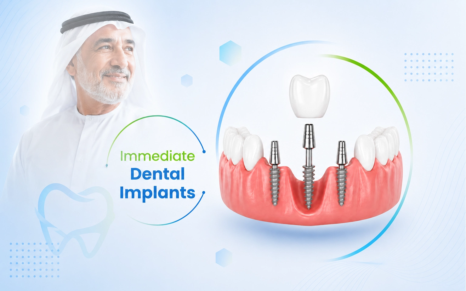 Immediate dental implants in India with same-day tooth replacement
