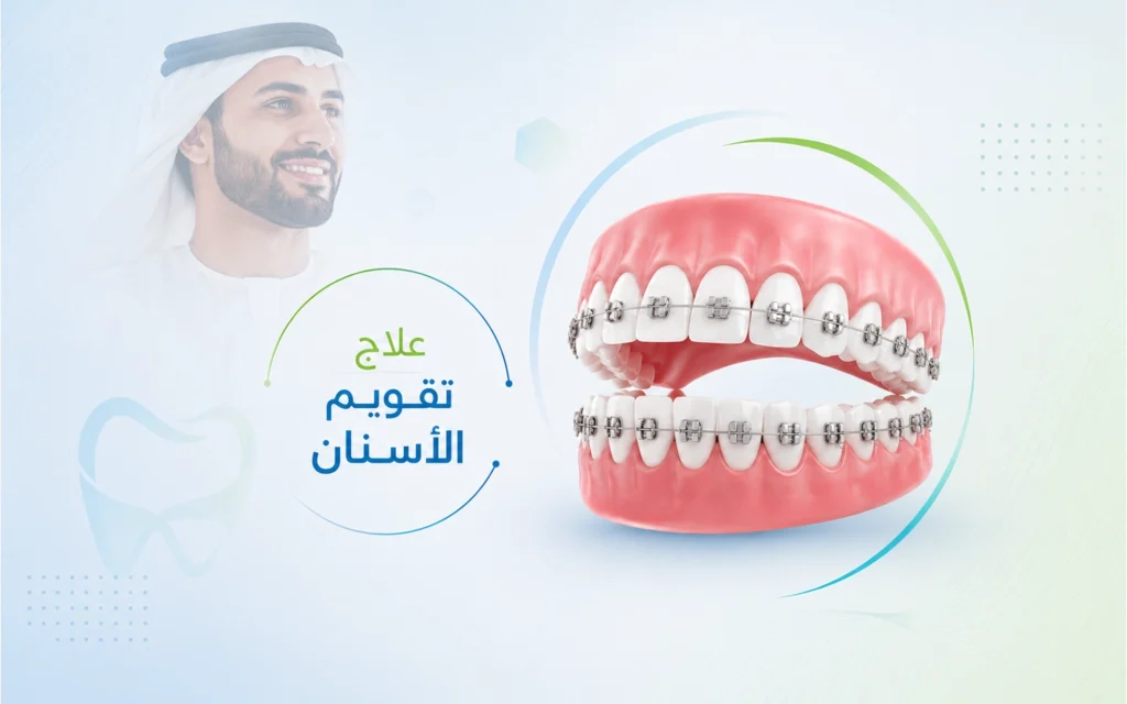 تقويم الأسنان في الهند