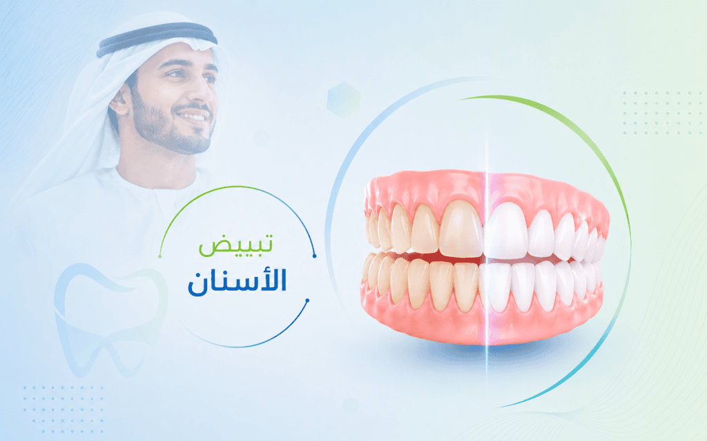 تبييض الأسنان في الهند