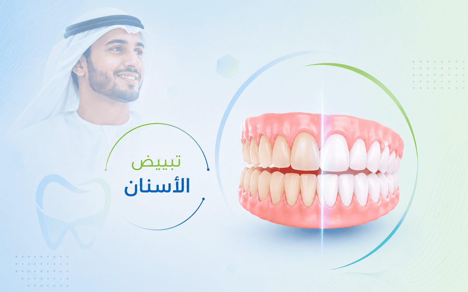 تبييض الأسنان في الهند لابتسامة مشرقة