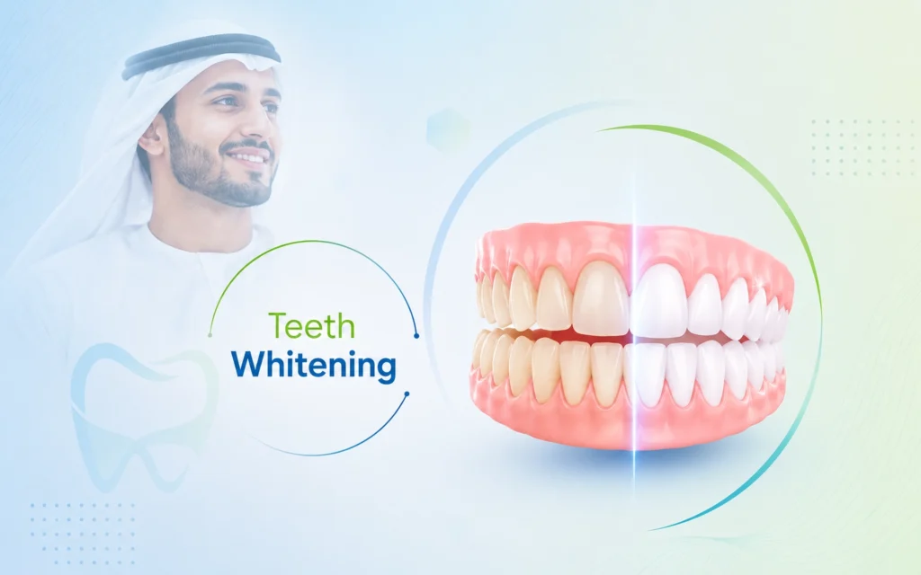 Teeth Whitening in India